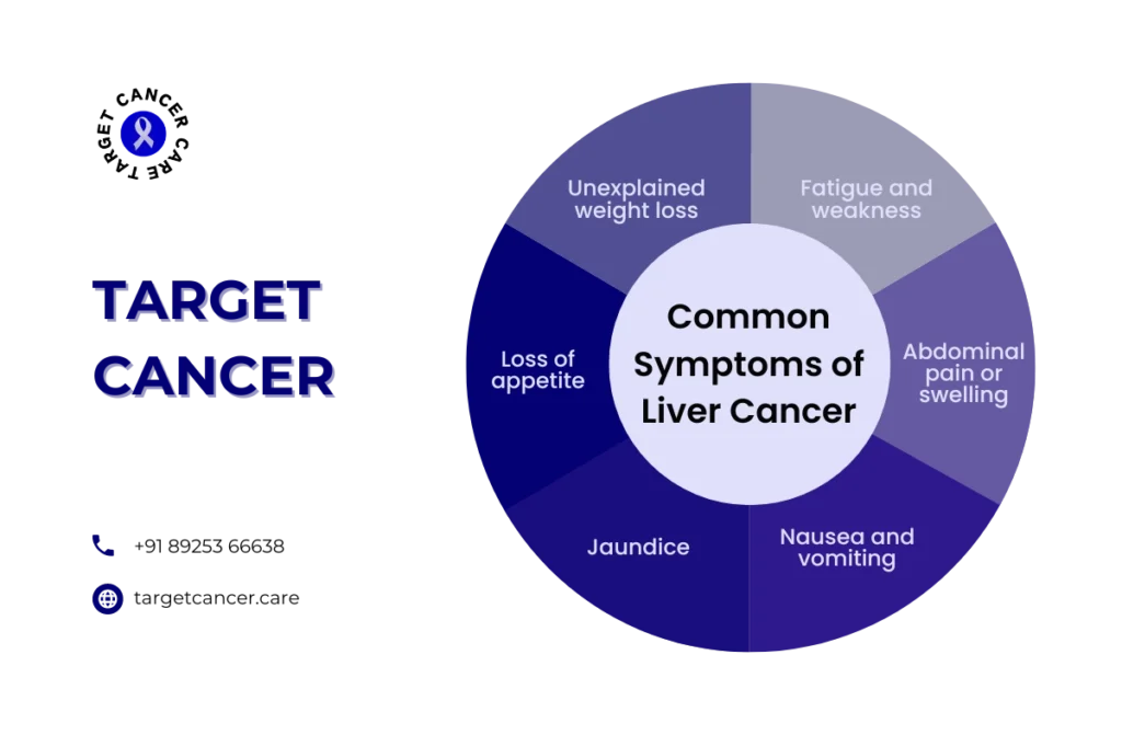 Best Liver Cancer Treatment in Chennai