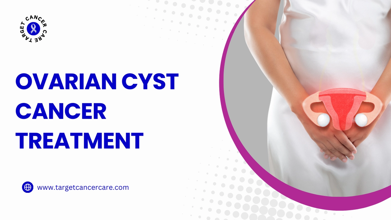 ovarian cyst cancer treatment in chennai