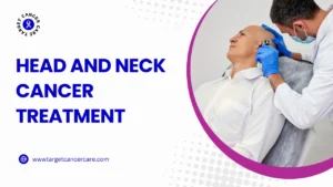 Head and Neck Cancer Treatment