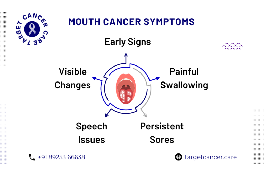 Mouth Cancer Symptoms