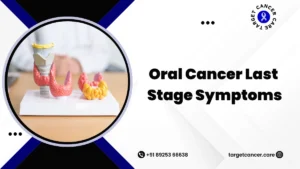 Oral cancer last stage symptoms