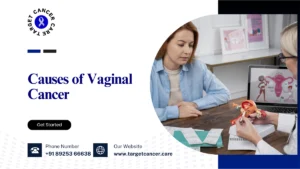 Causes of Vaginal Cancer