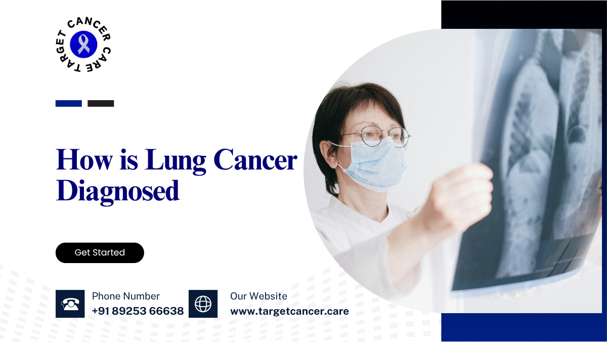 How is Lung Cancer Diagnosed