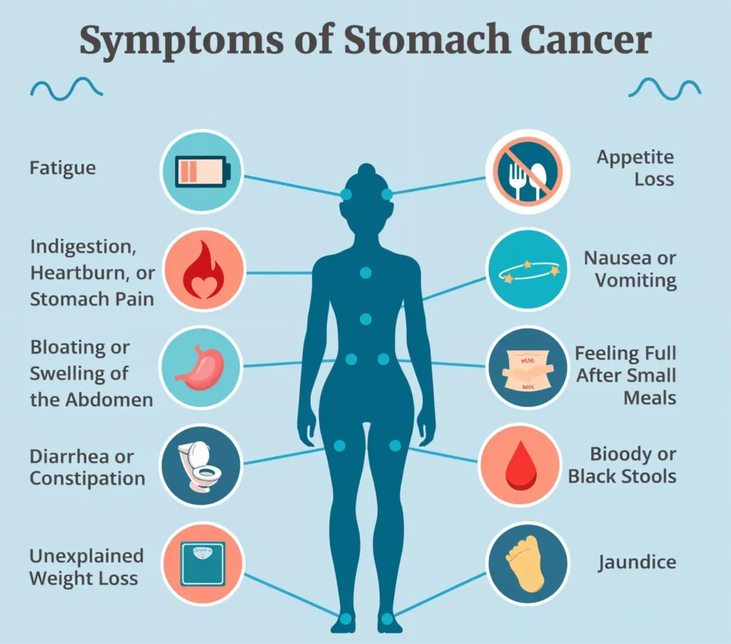Symptoms of Stomach Cancer