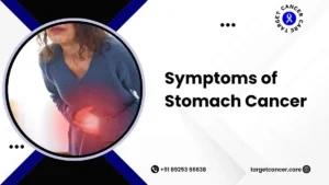 Symptoms of Stomach Cancer