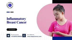 Inflammatory Breast Cancer