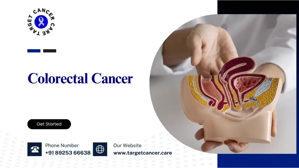 Colorectal Cancer